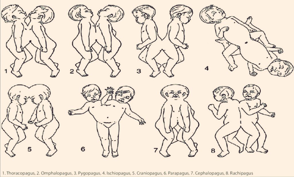 ʇsodɯoɔ tweet media