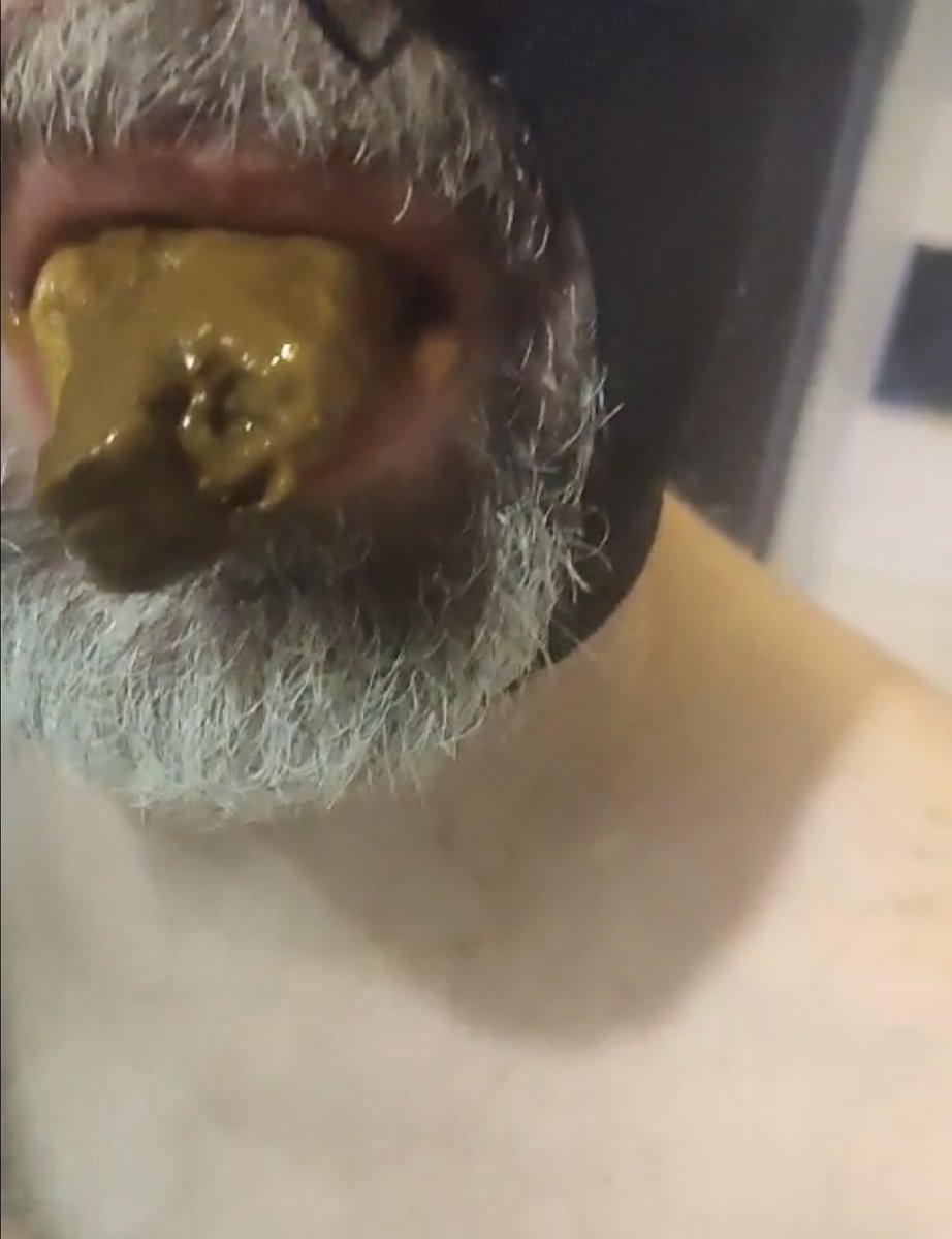 Mange Merde 💩🚽🐽 tweet media