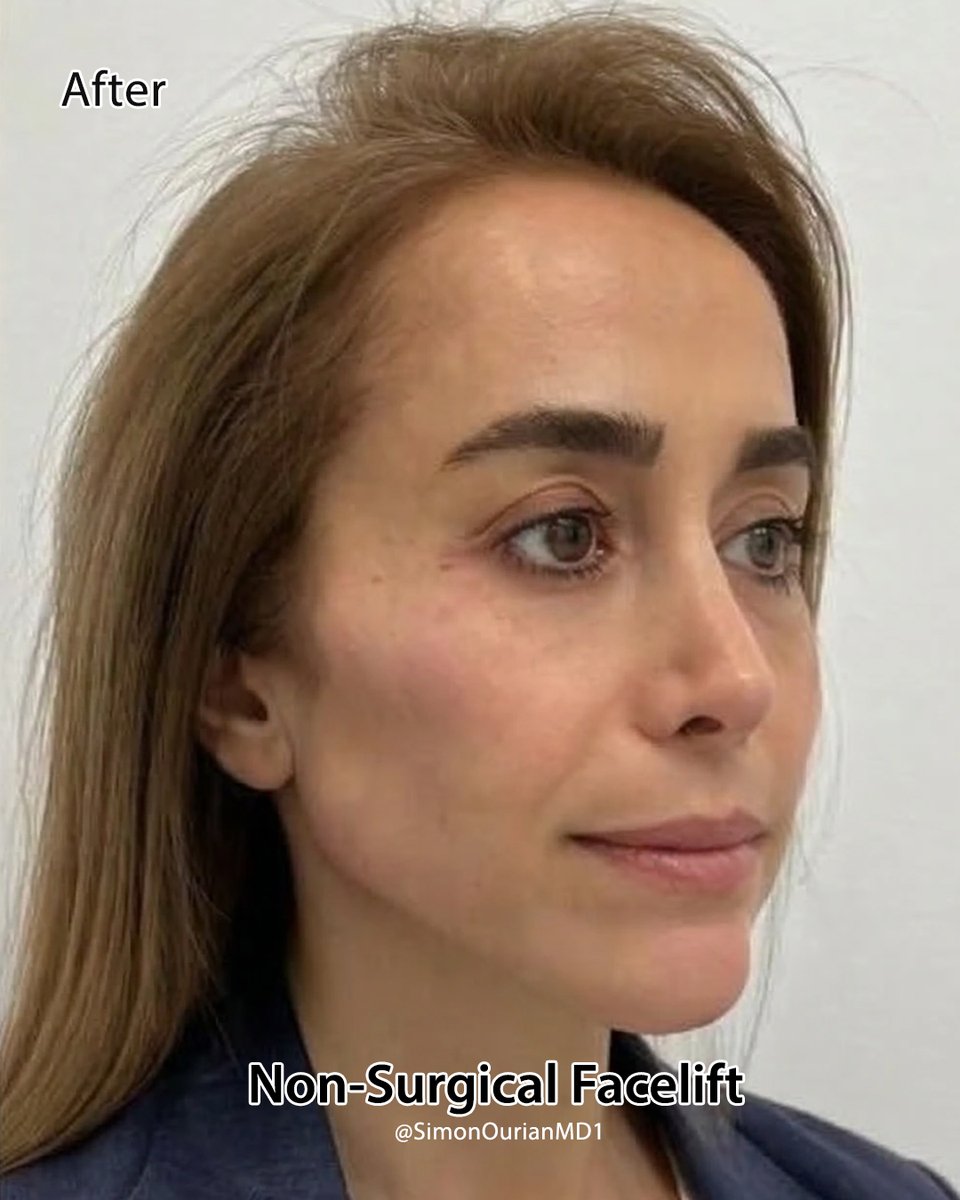 Dr. Simon Ourian - Epione tweet media