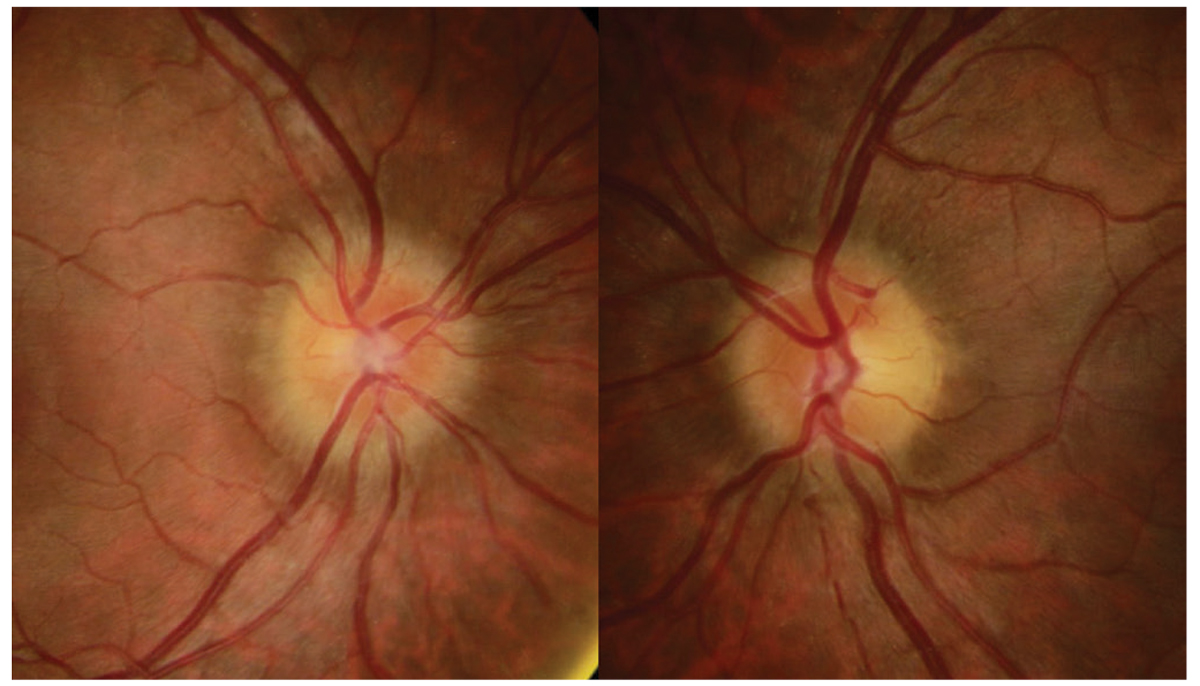 Review of Optometry tweet media