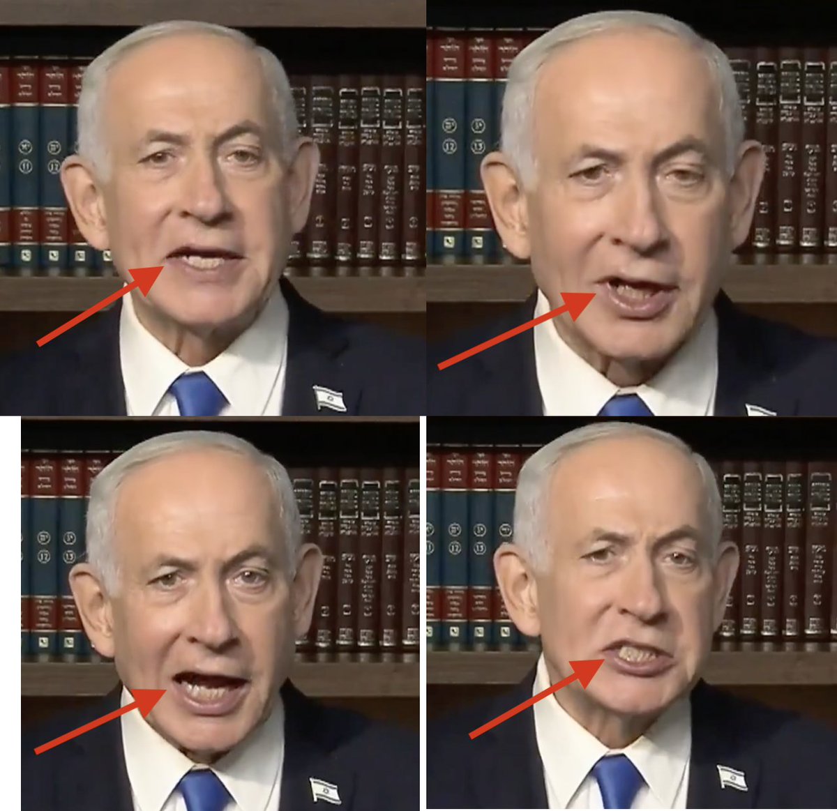 Dr(Prof)Deepak Natarajan MBBS MD DM tweet media