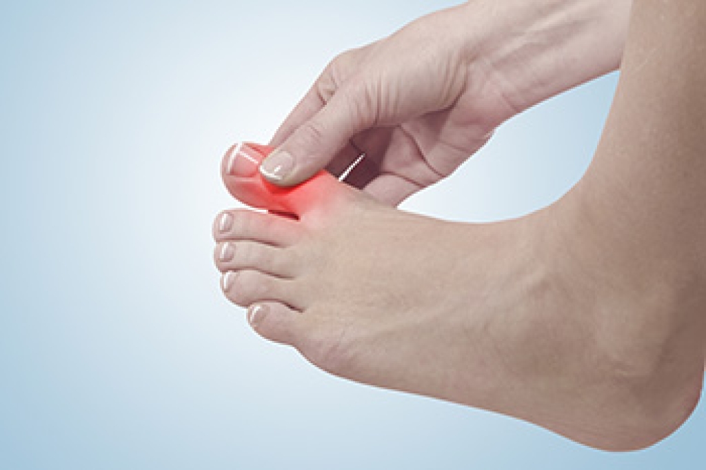 FoothillClinic's tweet photo. Dealing With Stiffness in the Big Toe https://t.co/FwqF6W6vrI https://t.co/MhehY3XyMY