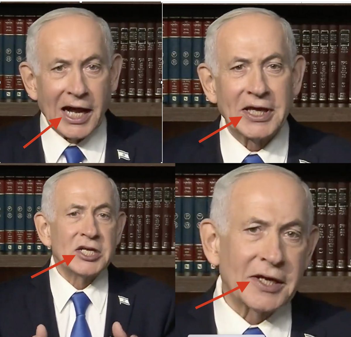 Dr(Prof)Deepak Natarajan MBBS MD DM tweet media