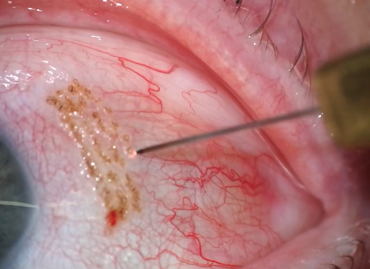 Review of Optometry tweet media