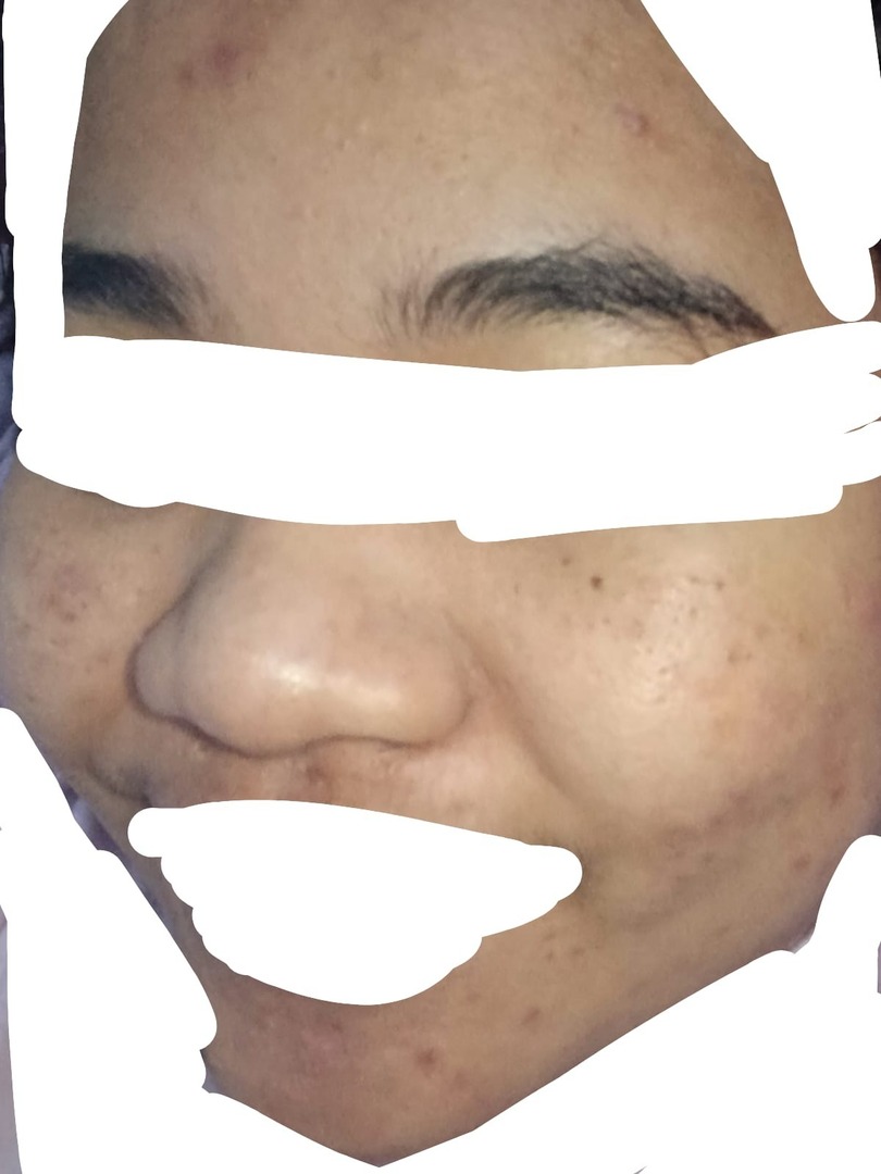 ✨OMBB | 🚫NO LINK tweet media