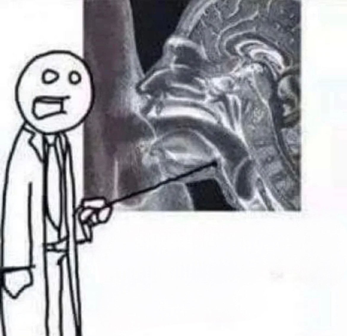 Les Reconquêtes se branlent sur des videos ou Rachida (la Macroniste) félicite Knafo de s'être désisté .
Des serpillères éternelles mdrrr.