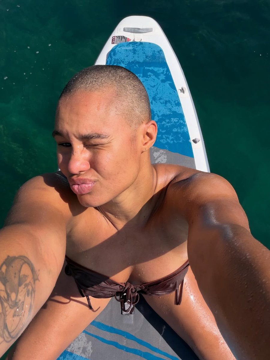 AthleteVanity's tweet photo. Hair is personal. Losing it is even more personal.

Satou Sabally shaved her head to bring visibility to alopecia — a condition that affects roughly 2% of the global population. That’s over 160 million people who will deal with this at some point in their lives. 

Alopecia doesn’t just take hair. Research shows those diagnosed face a 30-38% higher risk of anxiety, and are 82% more likely to experience unemployment. 40% of women with alopecia say it’s affected their marriage. This is a condition that reshapes identity, confidence and it’s barely talked about.

For a lot of people in the alopecia community, seeing a WNBA star stand in solidarity with them publicly? That’s everything.

Vulnerability at this level is its own kind of strength.

Respect, Satou ❤️