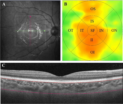 TVST Journal tweet media