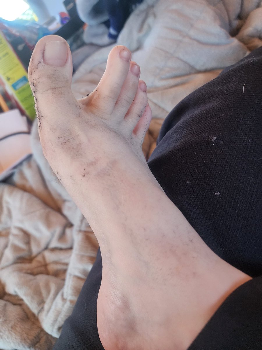 Bustycatof's tweet photo. Stinky feet cause I don't have boots and it's wet winter weather lmao #stinkyfeet #feetpics #feetfetısh #feetworshi̇p #dirtytoes #feet_pic #footfetısh #rightfoot https://t.co/qAlOZucJPH