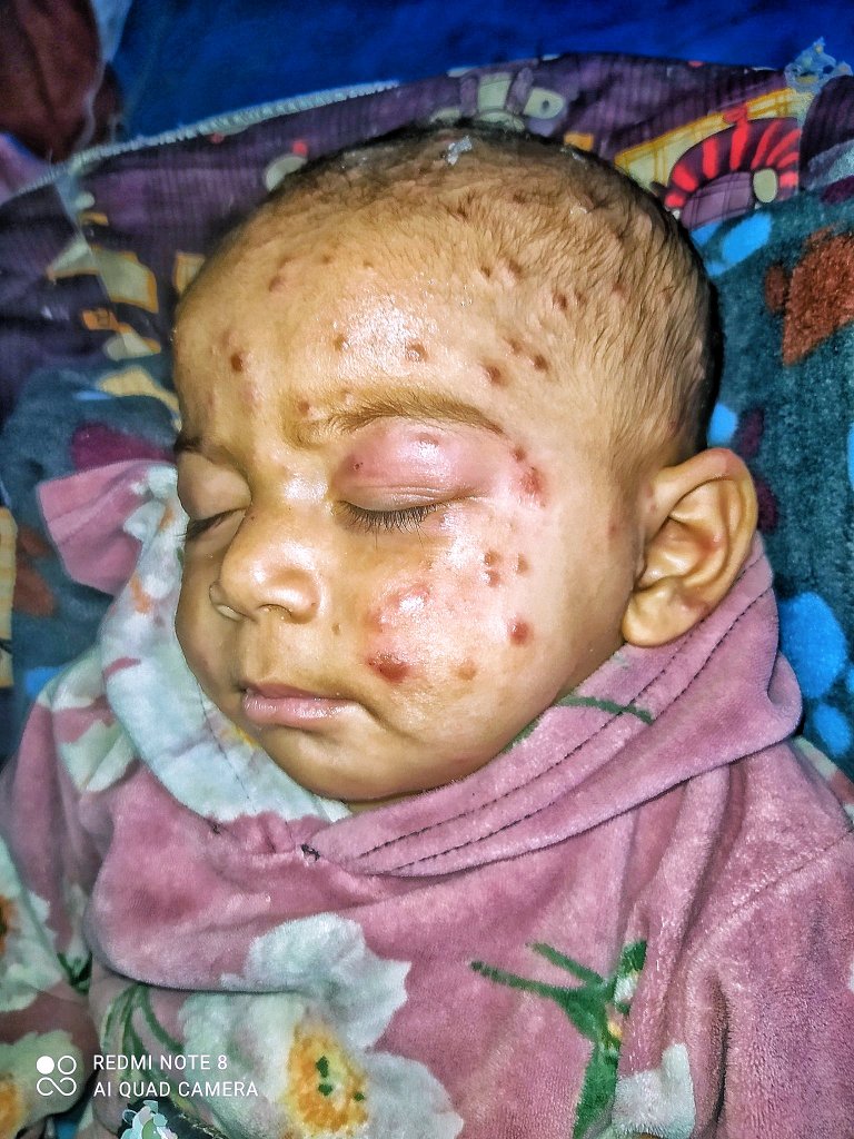 Mahmoud 🍉𝕏 tweet media