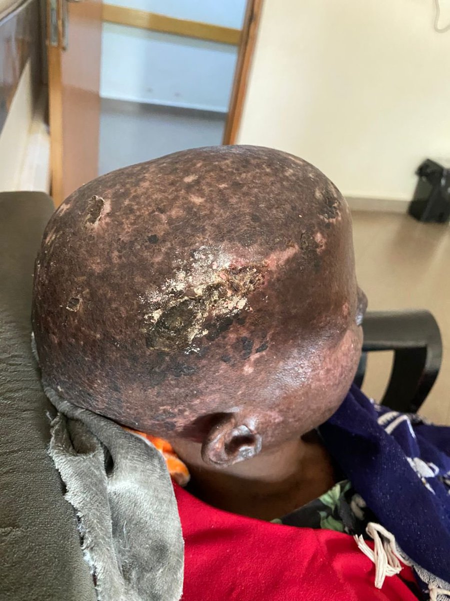 Jim Spire Ssentongo tweet media