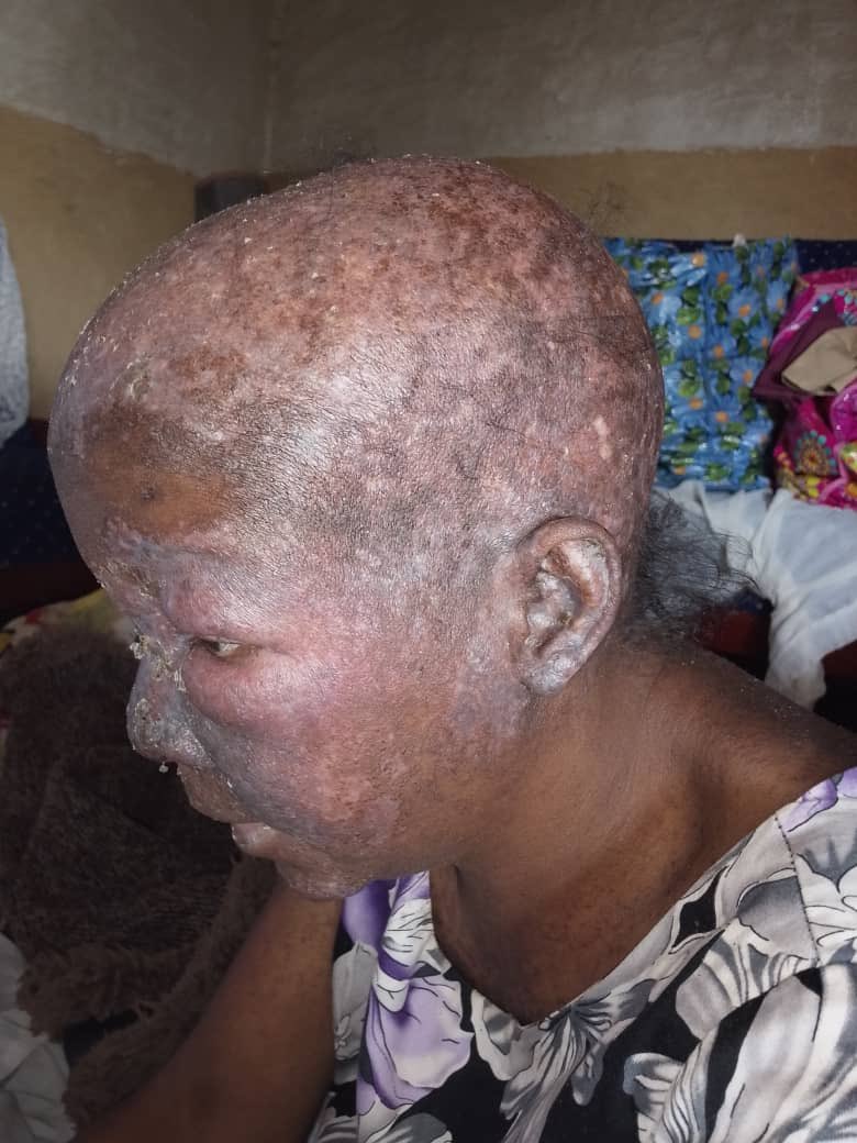 Jim Spire Ssentongo tweet media