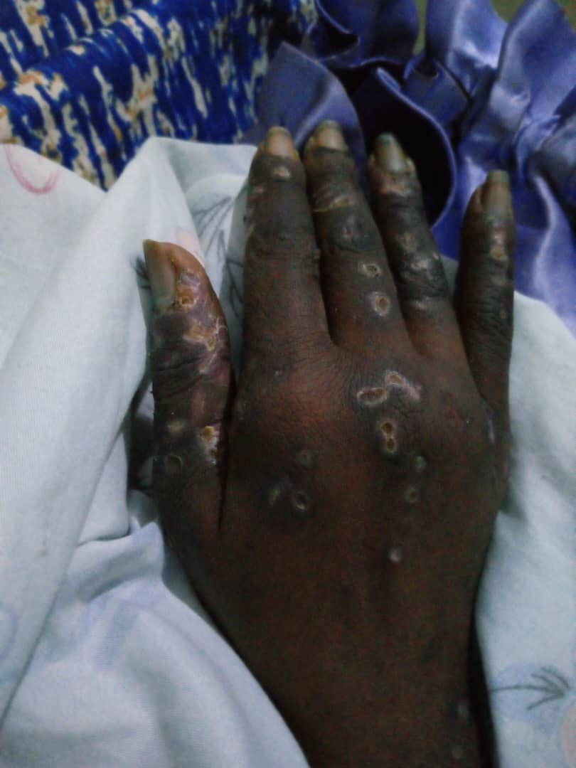 Jim Spire Ssentongo tweet media