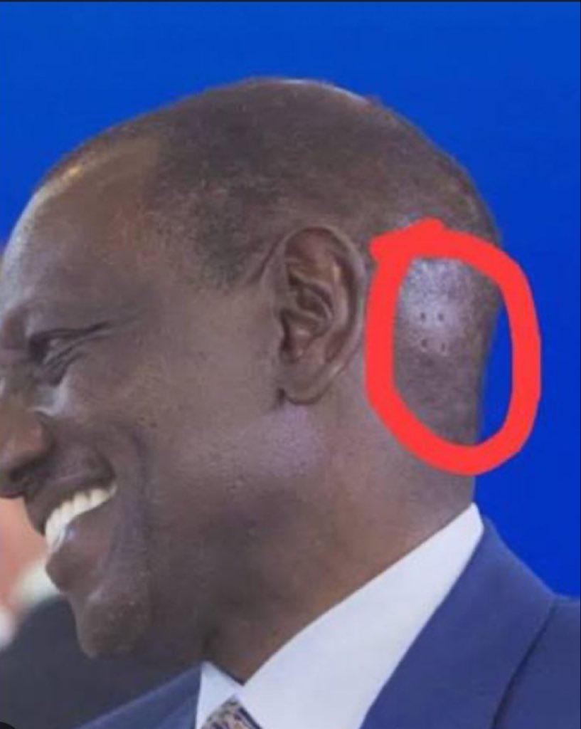 Dr.Stephen Obiero M.D tweet media