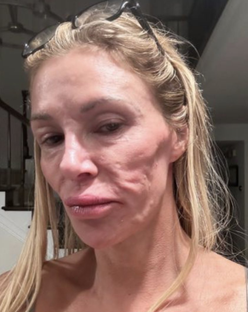 ☣️ Pleb Kruse = BTC foundationalist in exile 🟩🔆 tweet media