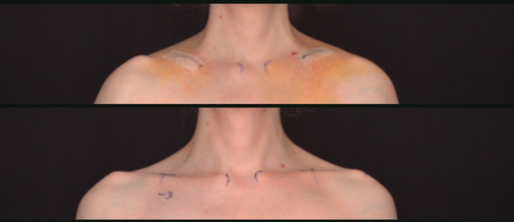 Fox Kaldir tweet media