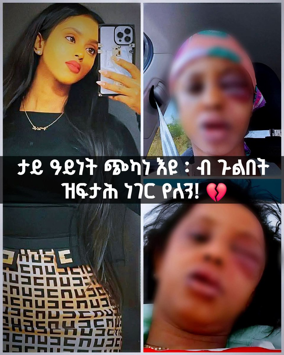 Gere Emun 💫 tweet media