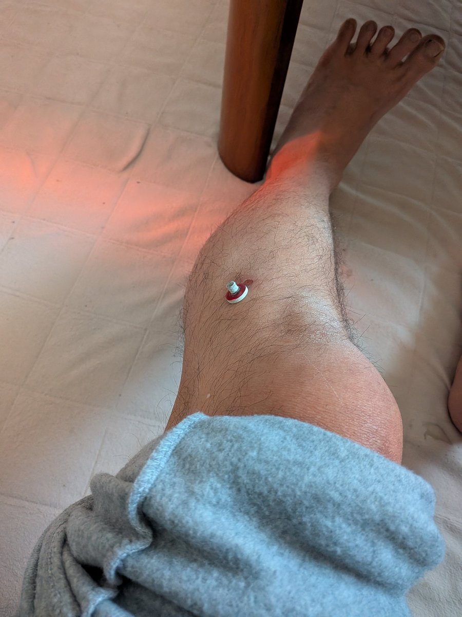 プロ餅 tweet media