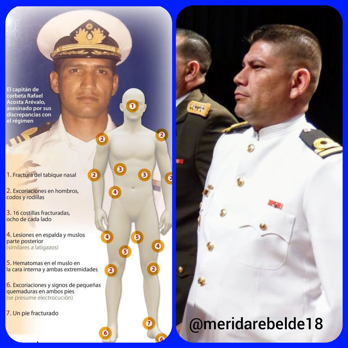 🚨¡ASESINO CONFIRMADO!
El Capitán de Corbeta ABEL ANGOLA, alias "Aureliano", Inspector Jefe del DGCIM, es el sádico que torturó y mató al Capitán Acosta Arévalo. ¡Le fracturó 16 costillas y lo electrocutó! ¡Que todo el mundo sepa quién es este criminal de lesa humanidad! 🔥💀🚫