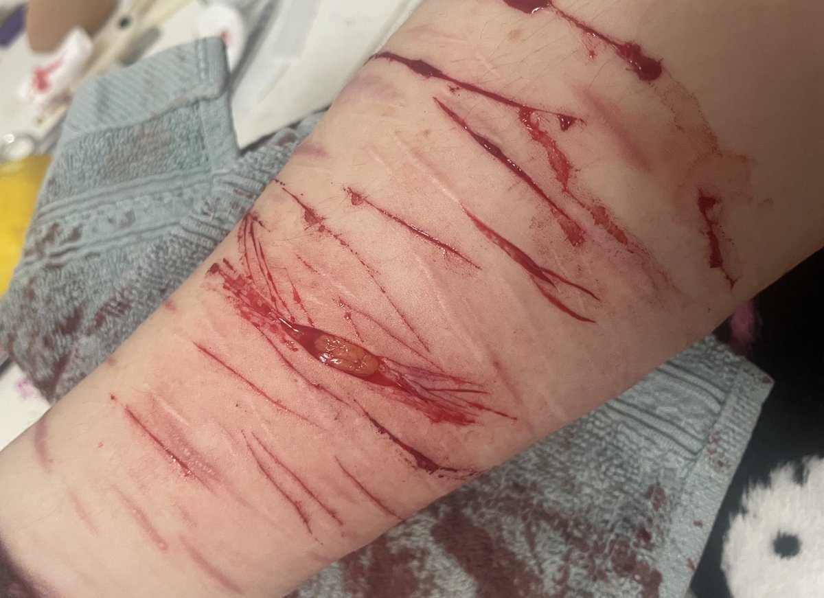 Yuricoochieeater of shtwt☽｡⋆ tweet media