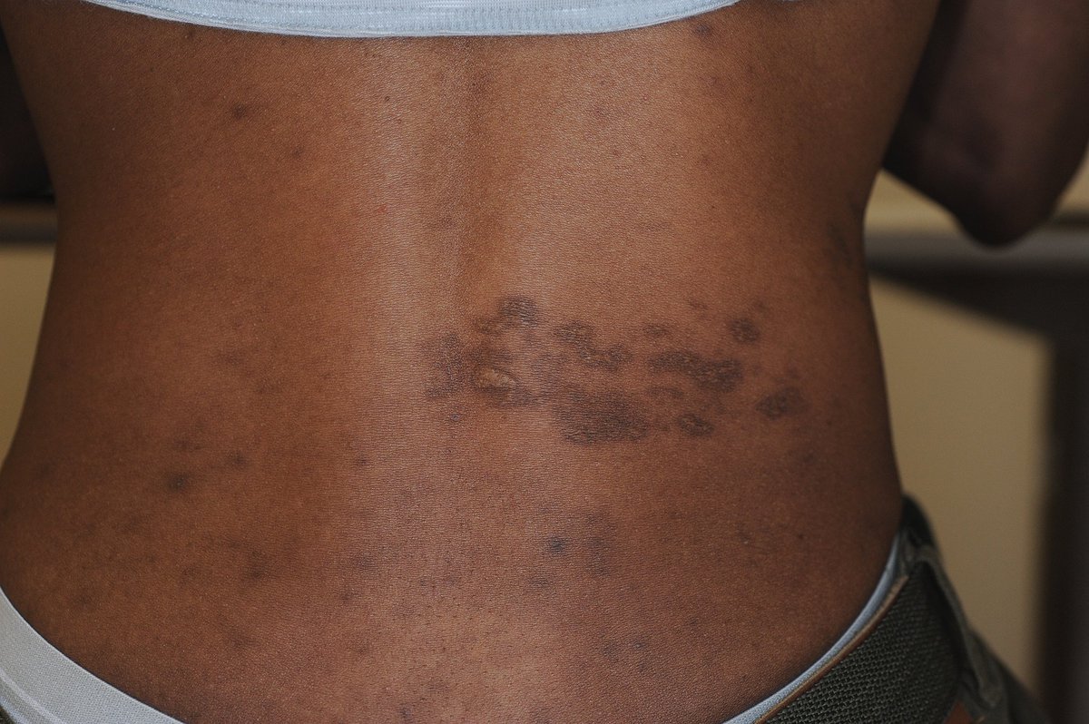 moth🩸 tweet media