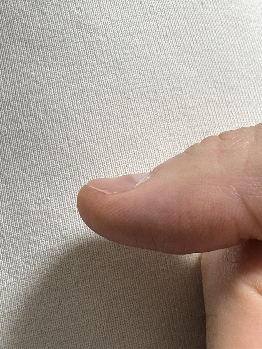 てつじ tweet media