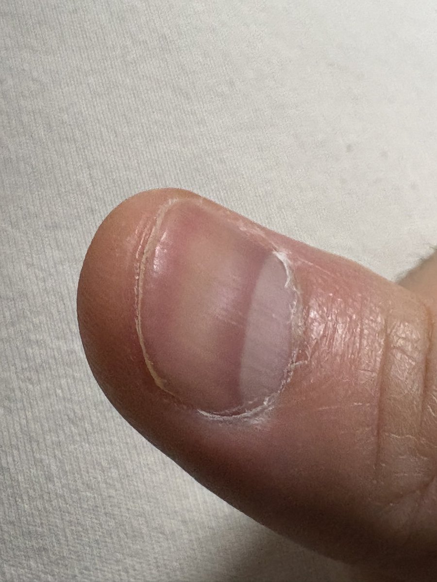 てつじ tweet media