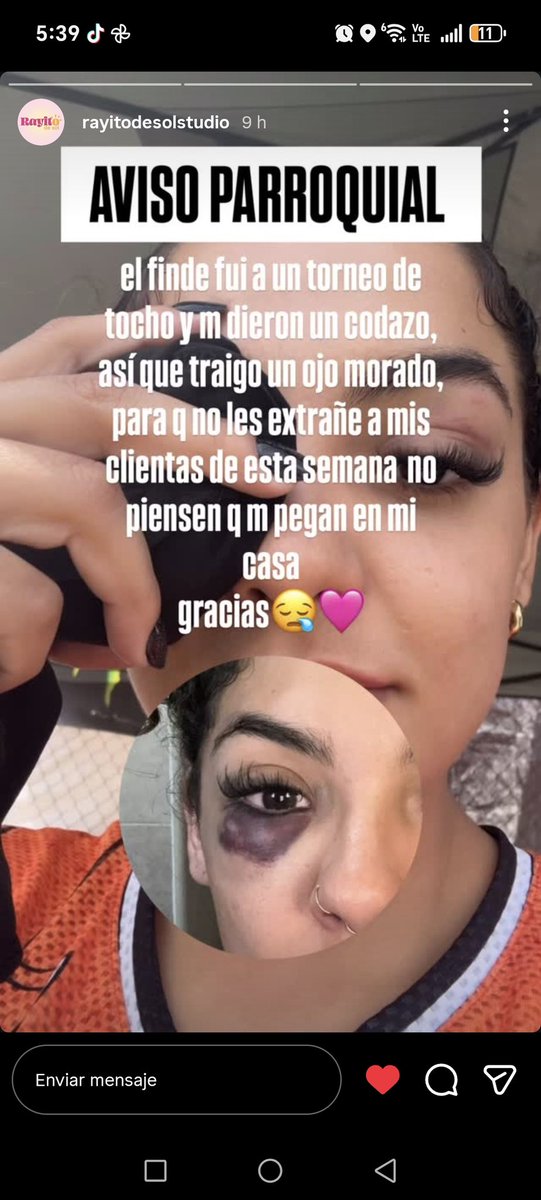 A mi novia le metieron un vergazo en un torneo de tocho y ahora la gente me ve feo pensando que yo le pego :(