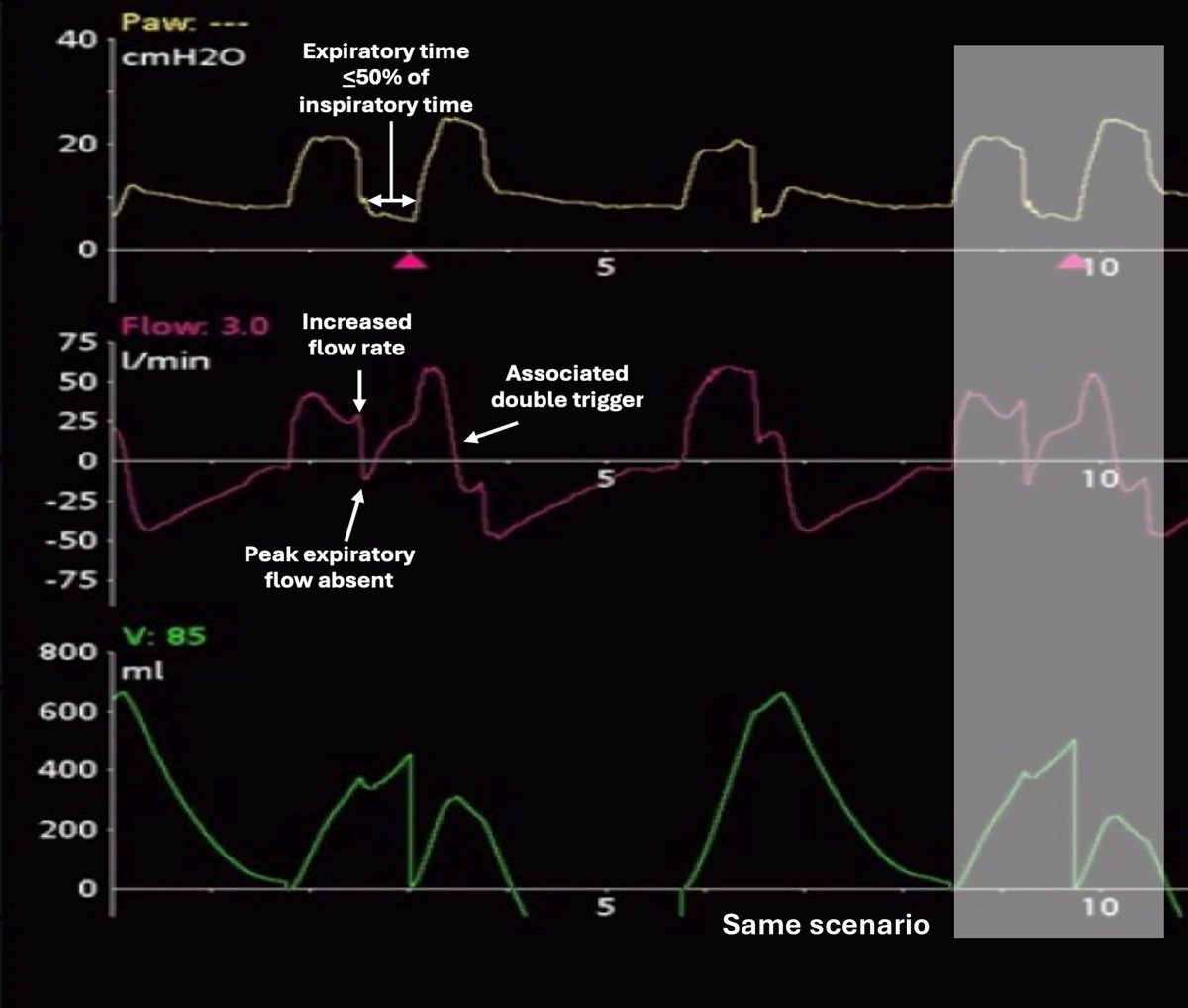 Society of Mechanical Ventilation tweet media