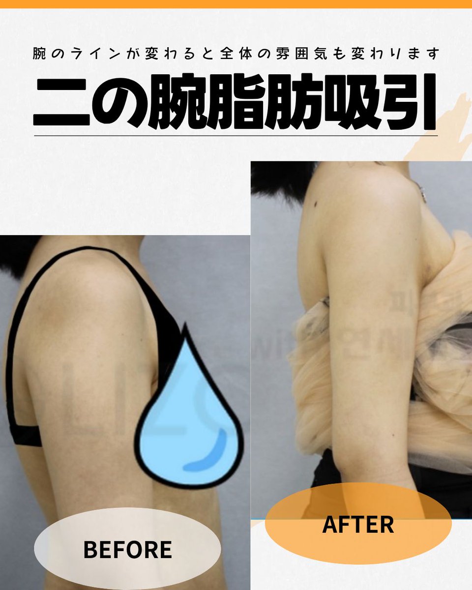 ヨンセスリムライン医院 tweet media