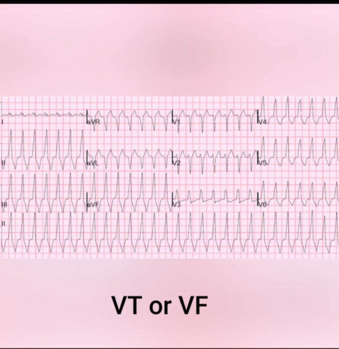 C.Alberto Ortega tweet media