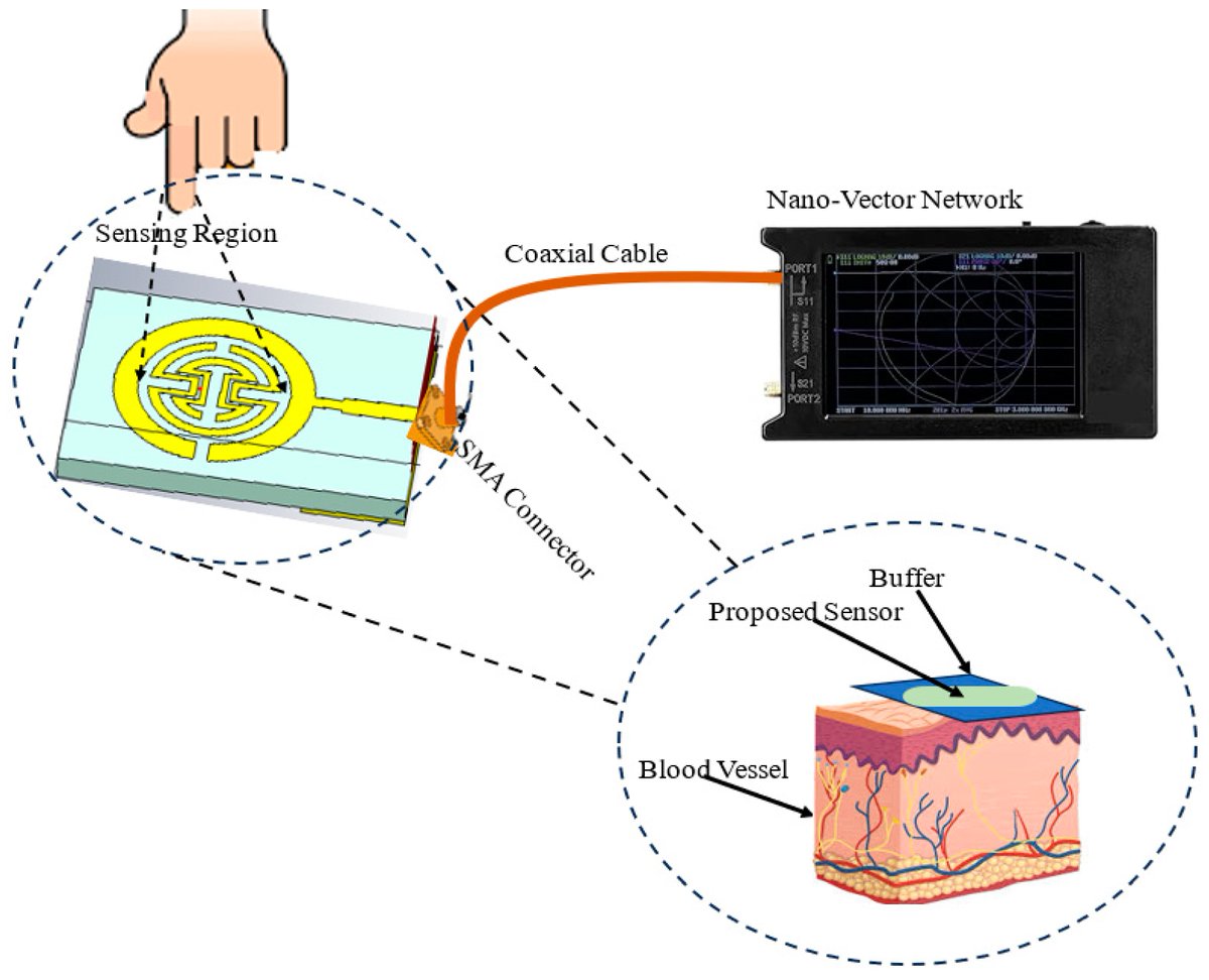 Biosensors_MDPI's tweet photo. π£Call for Reading:
#Article
Blood Glucose Monitoring Biosensor Based on Multiband Split-Ring Resonator Monopole Antenna
by Dalia N. Elsheakh et al.
https://t.co/95SOG0Wcoh
#BloodGlucoseMonitoring #SplitRingResonator #antenna
#biosensors #mdpi #openaccess https://t.co/VEhBV4G9Rg