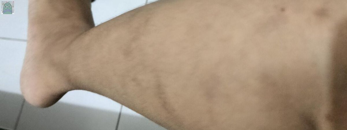 Tanyarlfes tweet media