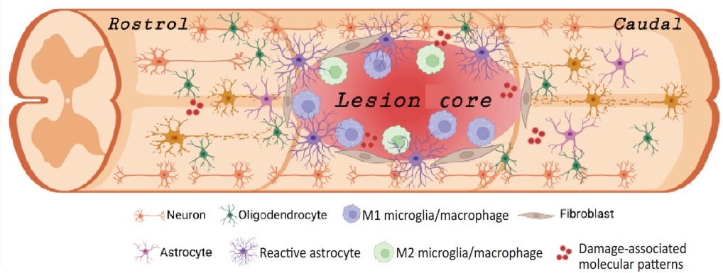 STMPUB's tweet photo. Online now: Current frontier technologies in spinal cord injury research: A narrative review. https://t.co/4AWrC19mec #SpinalCordInjury #SCIResearch #Neuroscience #Neurostimulation #StemCellTherapy #TissueEngineering #BCI #RegenerativeMedicine #MedicalInnovation #OpenAccess https://t.co/UeFFULGpsZ
