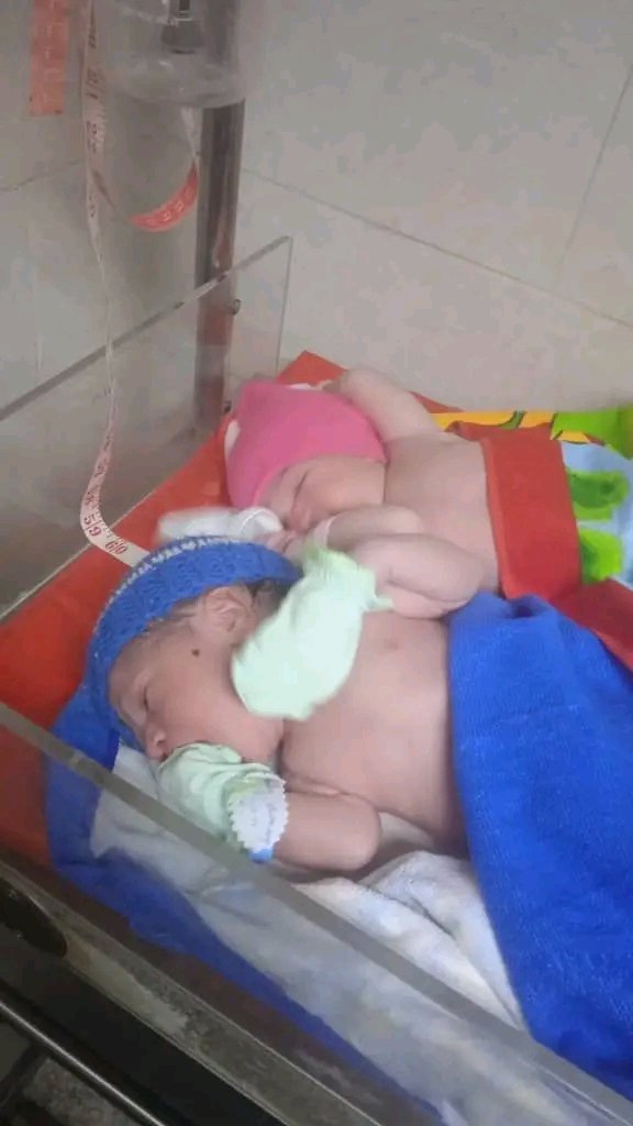 En el día de hoy nacen los gemelares de la mamá Sarabi Pedroso Vega, con peso de 3250 g primer gemelar femenino y 2750g segundo gemelar masculino. Gracias a la atención prenatal, esta madre cubana hoy goza el privilegio de tener 5 hijos.
Gracias Fidel!!
Gracias Revolución!!