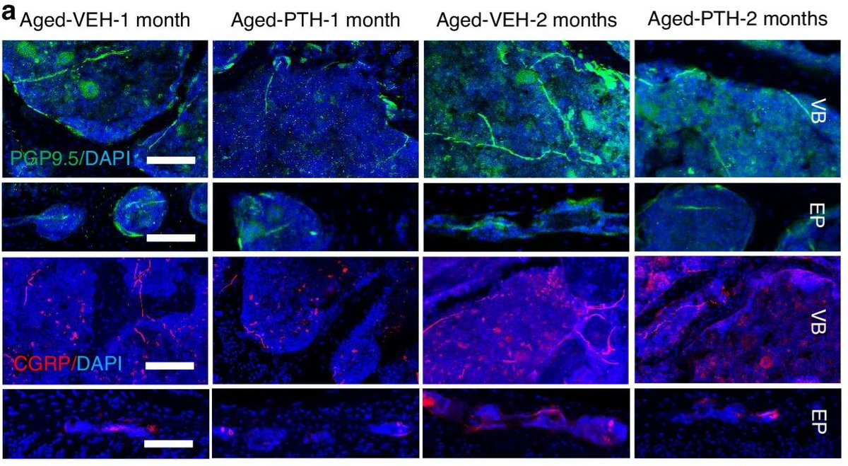 Bone Research_Editorial Office tweet media