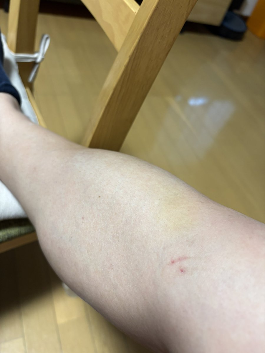 HEROひろ tweet media