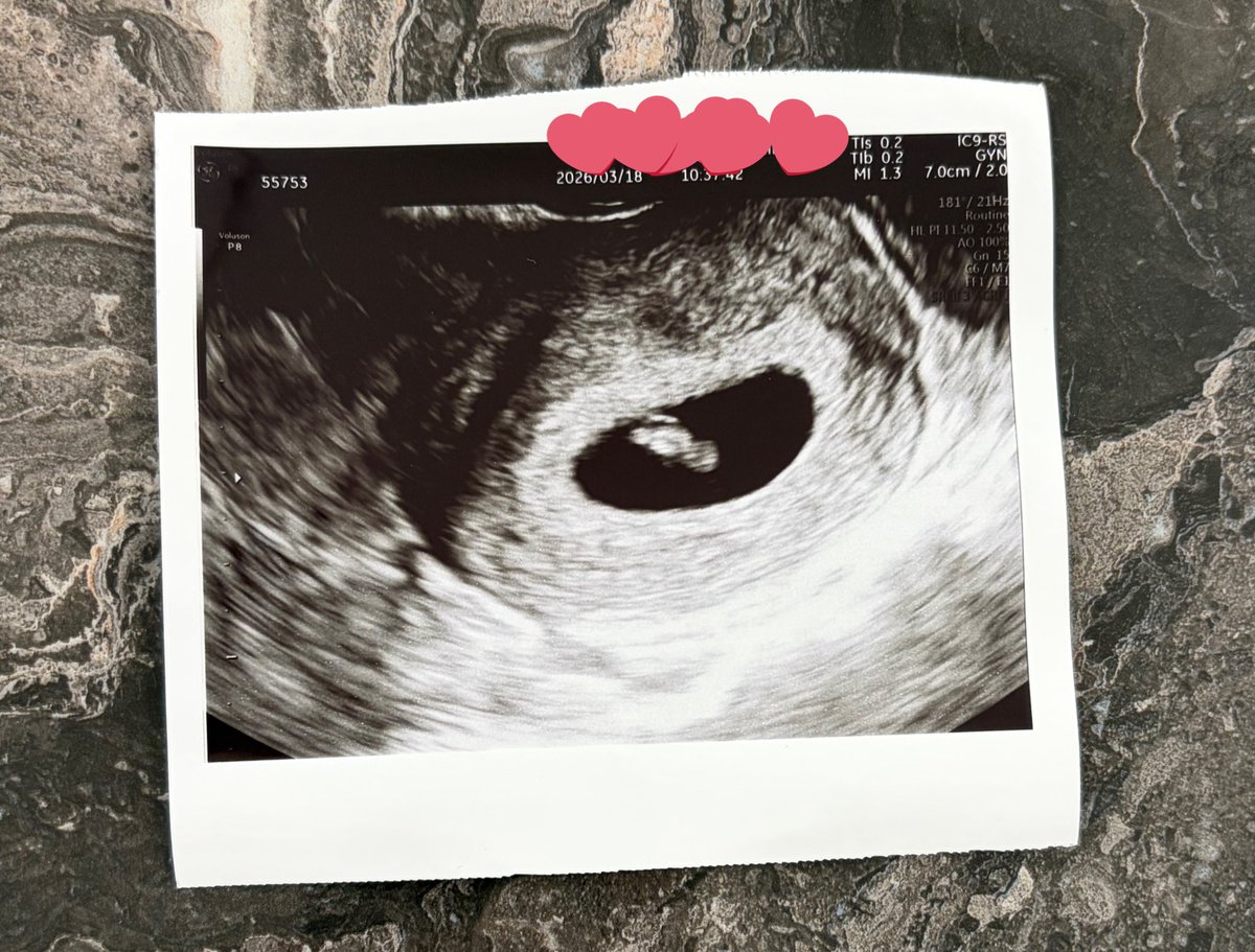 (本物)ろるこ🦞 tweet media