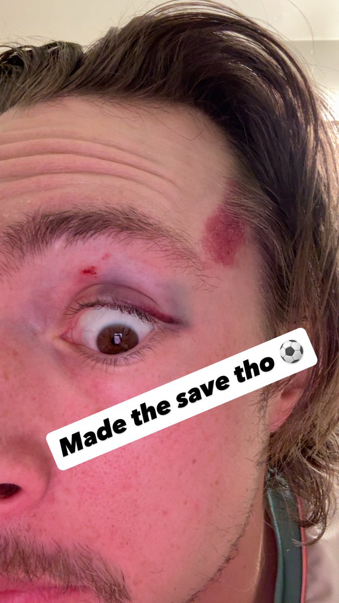 Ken Lester tweet media