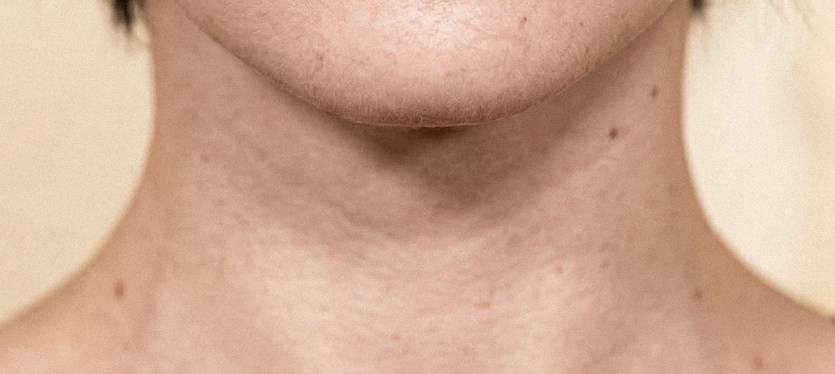 Siddarth Awax tweet media