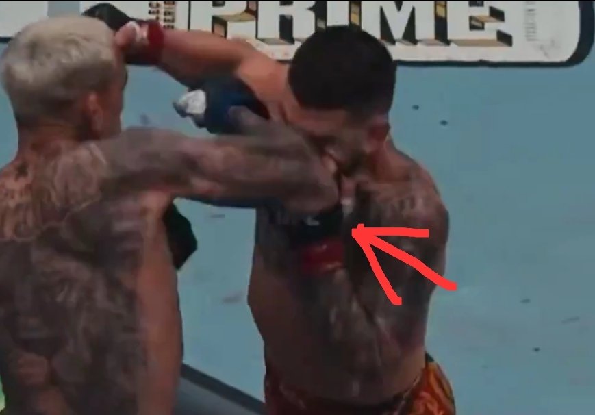 MeterPeter UFC tweet media