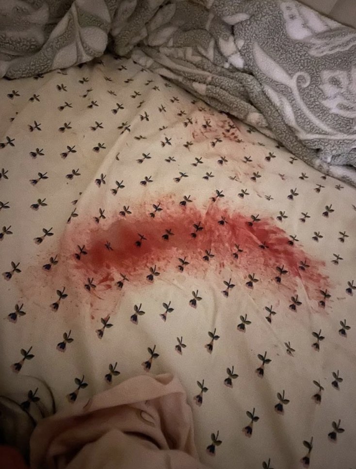 Gaëtan Caillot (Bambino) tweet media