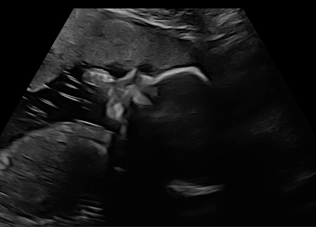 𝔐𝔬𝔪𝔪𝔞 ℭ𝔬𝔣𝔣𝔦𝔫𝔰 🏳️‍⚧️✨️ tweet media