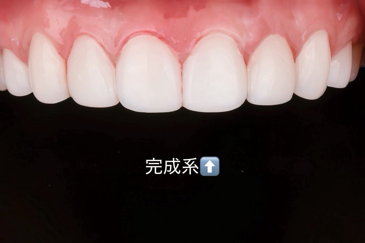 𝙢𝙞𝙣𝙖𝙢𝙞🩵 tweet media