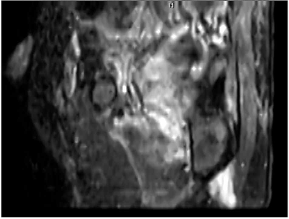 Spinal Cord Journal tweet media