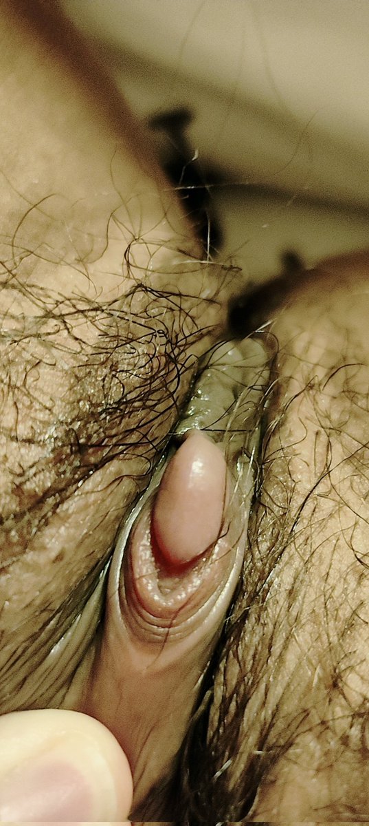 启明星 tweet media