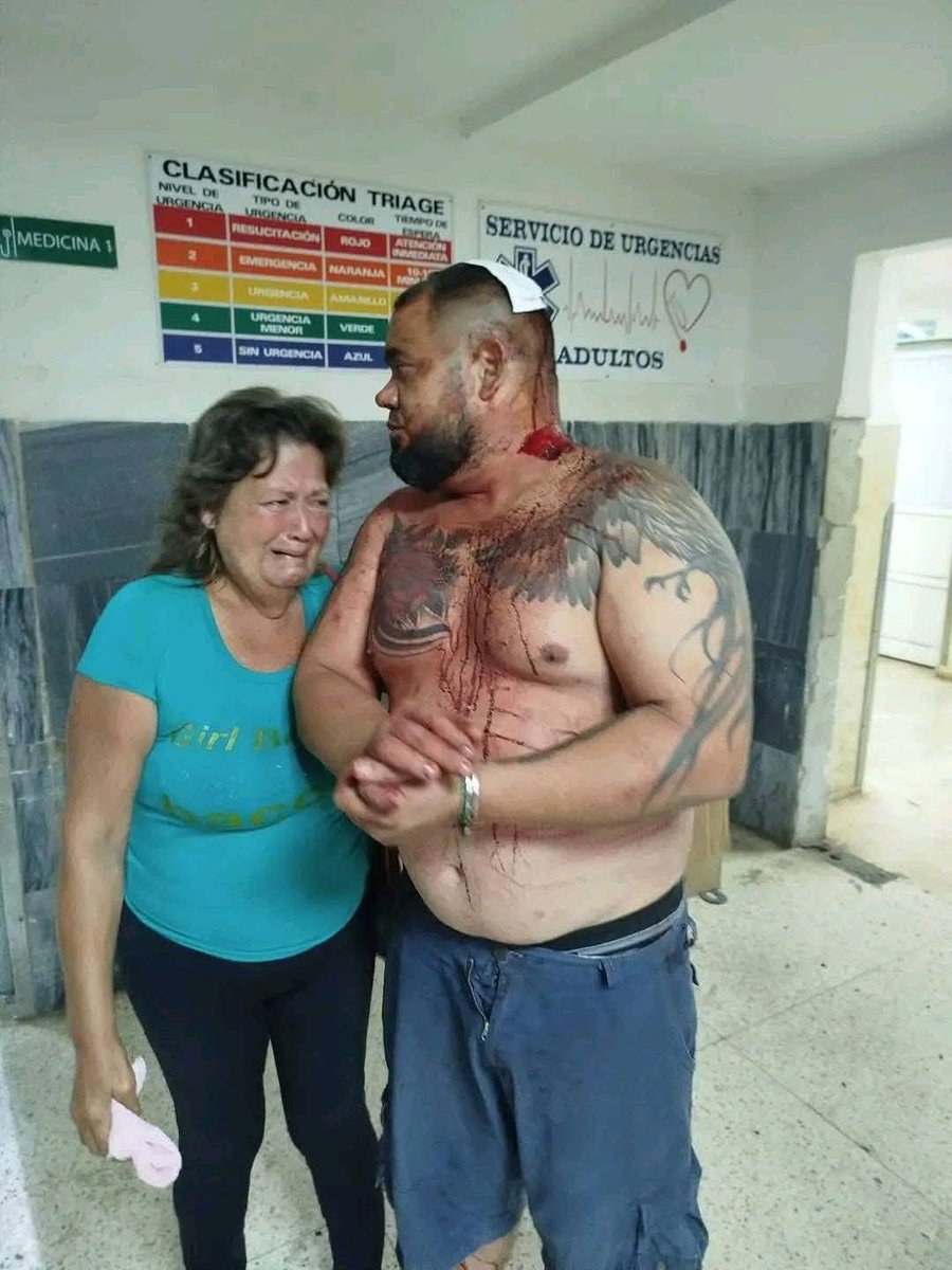 #Cuba 🇨🇺
Esta es la cara de la represión en Morón, Ciego de Ávila. Un hombre bañado en sangre tras la brutal golpiza de las boinas negras. El pueblo grita libertad y el régimen responde con violencia. ¡Basta ya! #MoronEnLaCalle #CubaLibre #AbajoLaDictadura #PatriaYVida