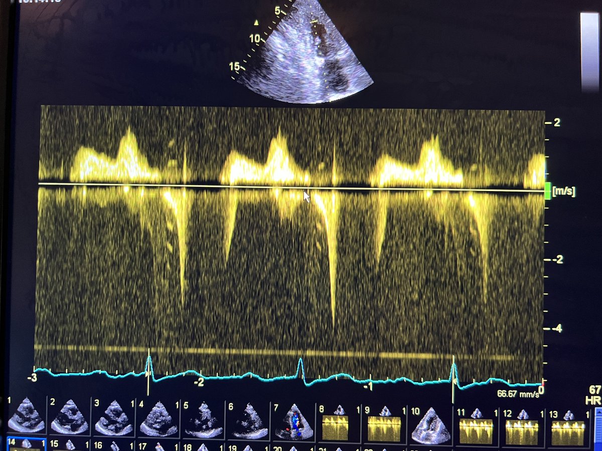 Batman-Echo tweet media