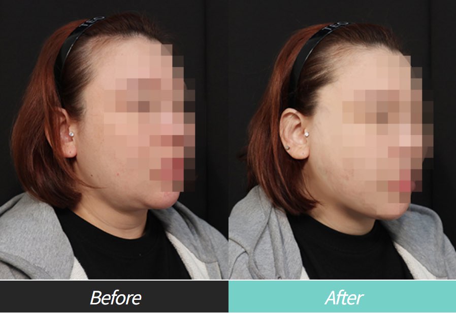 【公式】リバースクリニック | 江南・明洞・弘大 tweet media