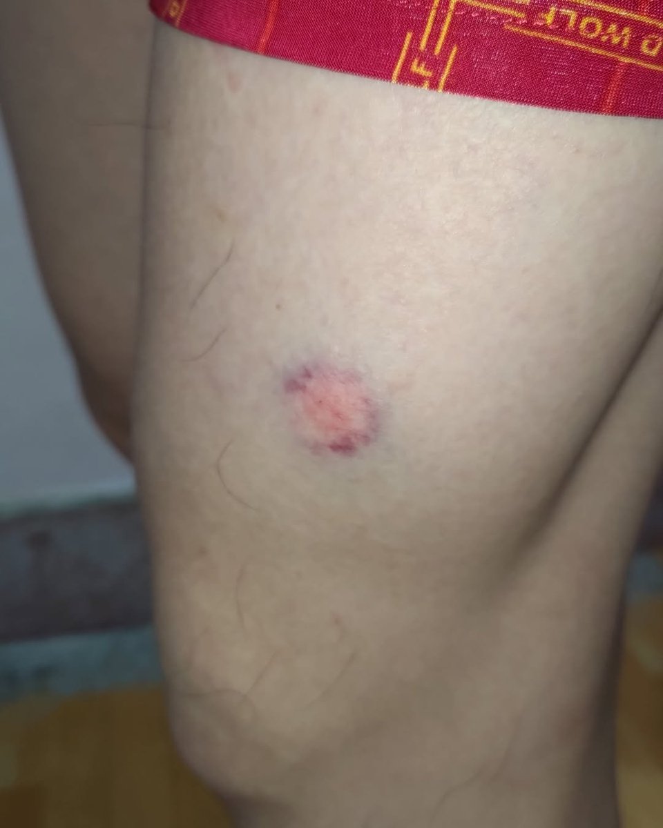 NoYoC_Airsoft's tweet photo. 左大腿受到了攻擊

左太ももやばいだぜ

The left leg got a clean hit https://t.co/ghZqcOkOiJ